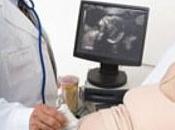 Reconocer llegada parto