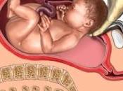 ¿Por programa cesárea?