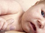 Cólico lactante