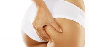 Plantas que combaten la celulitis