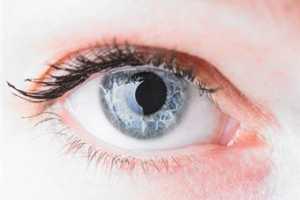 Remedios caseros contra las cataratas