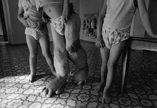 25 años de Chernobyl, el peor accidente nuclear de la historia 25 años de Chernobyl, el peor accidente nuclear de la historia