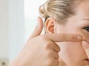 consejos para tratar acné.