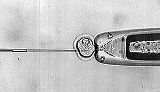 Cuestionan tratamiento para curar Alzheimer