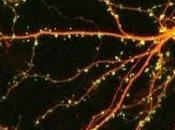 neuropsina, culpable ansiedad
