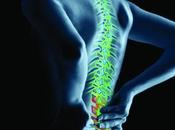 Artricenter: debes saber osteoartrosis espalda.