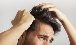 Qué hacer cuando la calvicie acecha - Trucos de salud caseros
