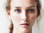 Dermatitis tiempos hielo