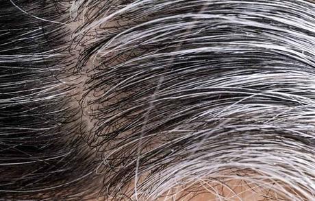 14 Tratamientos Naturales para las Canas.