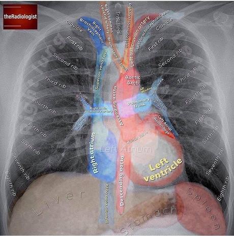 Radiologia convencional y anatomía Radiologia convencional y anatomía