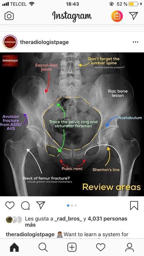 Radiologia convencional y anatomía Radiologia convencional y anatomía