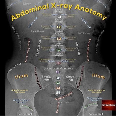 Radiologia convencional y anatomía Radiologia convencional y anatomía