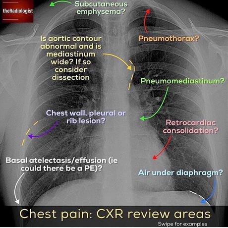 Radiologia convencional y anatomía Radiologia convencional y anatomía