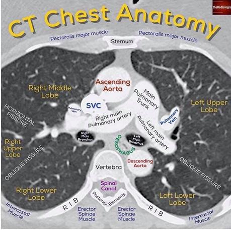 Radiologia convencional y anatomía Radiologia convencional y anatomía