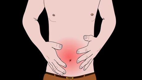 Síntomas úlcera de estómago