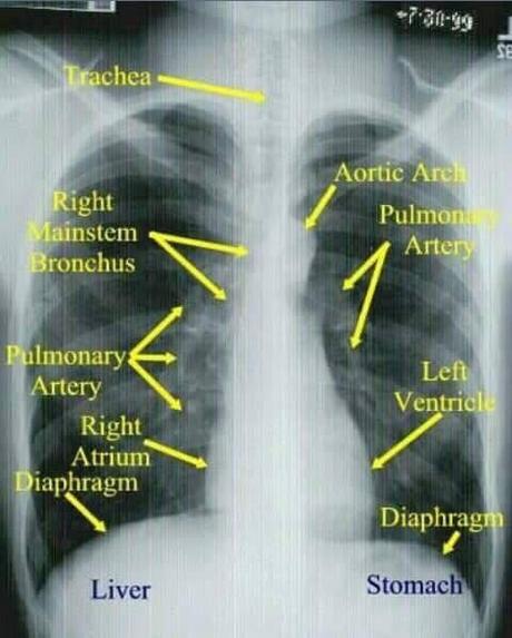 Signos radiológicos