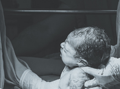 cesárea fotografiada