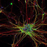La Capacidad Cerebral mejora al aumentar el número de Neuronas