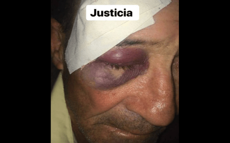 Joven cubana pide justicia para el hombre que golpeó brutalmente a su tío