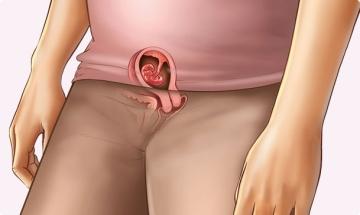 5 semanas de embarazo – Segundo mes 5 semanas de embarazo – Segundo mes