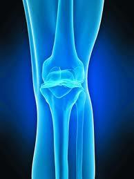 Prevenir y tratar dolor en rodillas