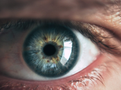 iridotomía láser importancia casos glaucomas agudos