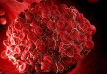 Lo que hay que saber sobre un coágulo de sangre detrás de la rodilla Coágulo de sangre detrás de la rodilla