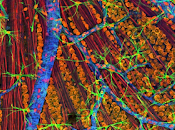 Optometristas entrenados capaces como oftalmólogos monitorear degeneración macular relacionada edad.