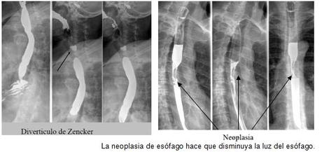 Anatomía radiológica del peritoneo y tubo digestivo