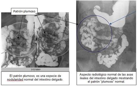 Anatomía radiológica del peritoneo y tubo digestivo