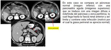 Anatomía radiológica del peritoneo y tubo digestivo