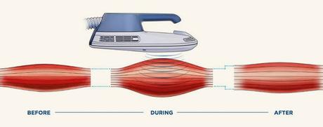 ¿SE PUEDE POTENCIAR EL MUSCULO SIN HACER EJERCICIO? AHORA SI CON LA NUEVA TECNOLOGIA HIFEM ¿SE PUEDE POTENCIAR EL MUSCULO SIN HACER EJERCICIO? AHORA SI CON LA NUEVA TECNOLOGIA HIFEM