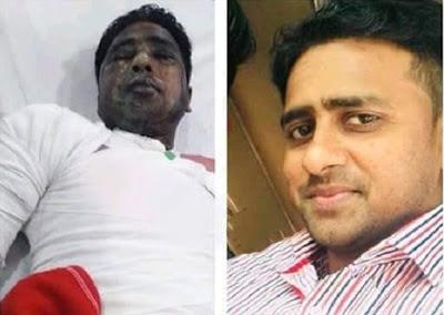 Cristiano Paquistaníes atacado con ácido por su fe