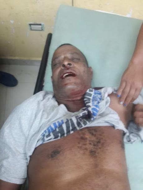 En Barahona hombre muere de disparo a manos de sobrino