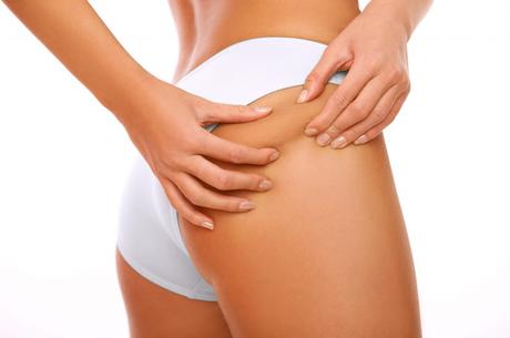 ¿Se puede evitar la CELULITIS? ¿Se puede evitar la CELULITIS?