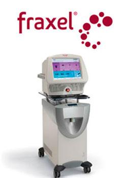 ¿Qué tratamiento es el más idóneo para eliminar las cicatrices por acné? ¿Qué tratamiento es el más idóneo para eliminar las cicatrices por acné?