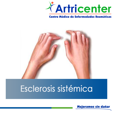 Artricenter: Esclerosis sistémica