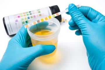 Diagnóstico de las infecciones urinarias durante el embarazo Diagnóstico de las infecciones urinarias durante el embarazo