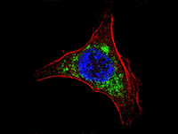 Generan Nuevas Vacunas contra el Virus de la Hepatitis C