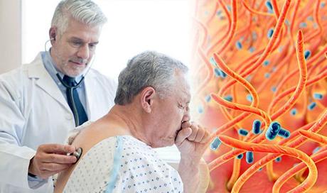 tos ferina en adultos