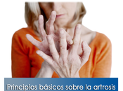 Artricenter: Principios básicos sobre artrosis