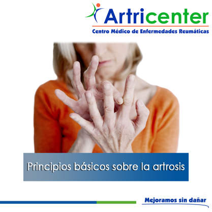 Artricenter: Principios básicos sobre la artrosis Artricenter: Principios básicos sobre la artrosis