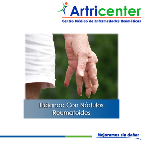 Artricenter: Lidiando con nódulos reumatoides