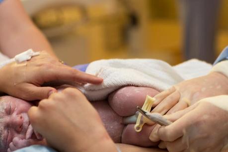 Ventajas de las células del cordón umbilical