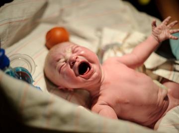 Ventajas de las células del cordón umbilical Ventajas de las células del cordón umbilical