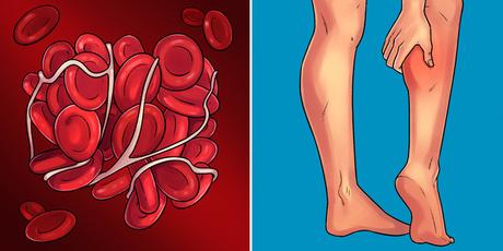 10 enfermedades serias