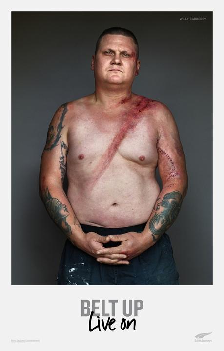 Esta campaña de seguridad vial muestra las marcas que dejan los accidentes en las víctimas