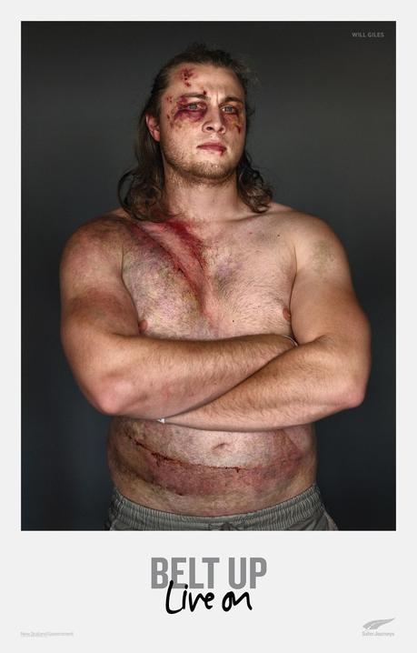 Esta campaña de seguridad vial muestra las marcas que dejan los accidentes en las víctimas