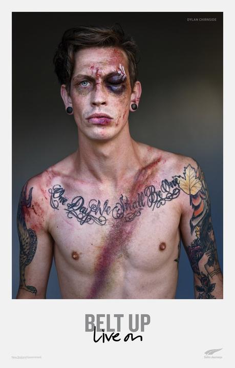 Esta campaña de seguridad vial muestra las marcas que dejan los accidentes en las víctimas