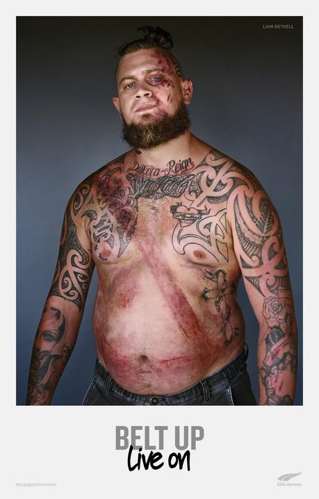 Esta campaña de seguridad vial muestra las marcas que dejan los accidentes en las víctimas